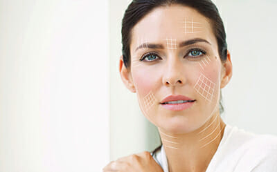 Ästhetische Gesichtsbehandlung mit Hyaluronsäure und PDO – Fäden